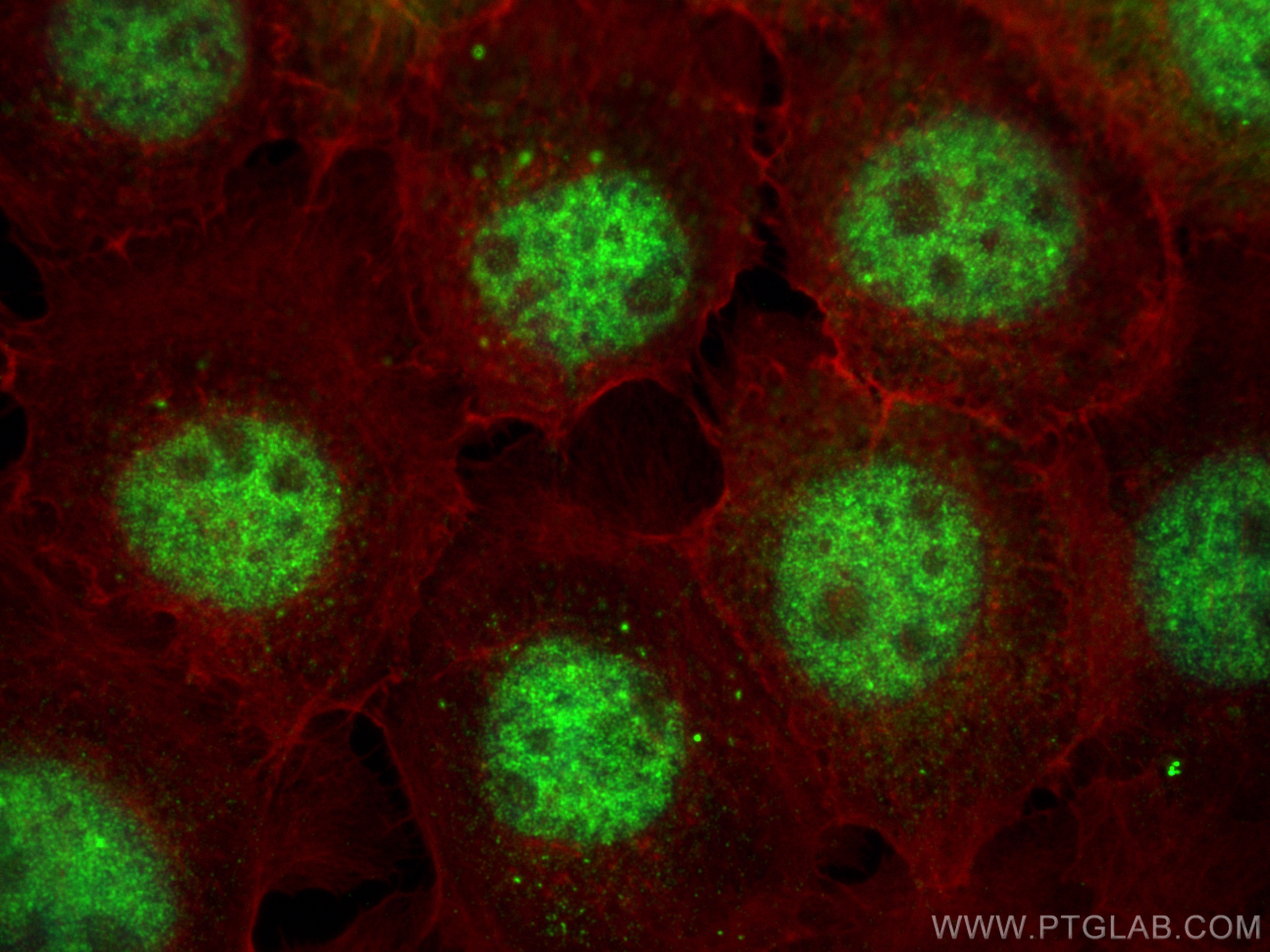 IF Staining of A431 using 11705-1-AP