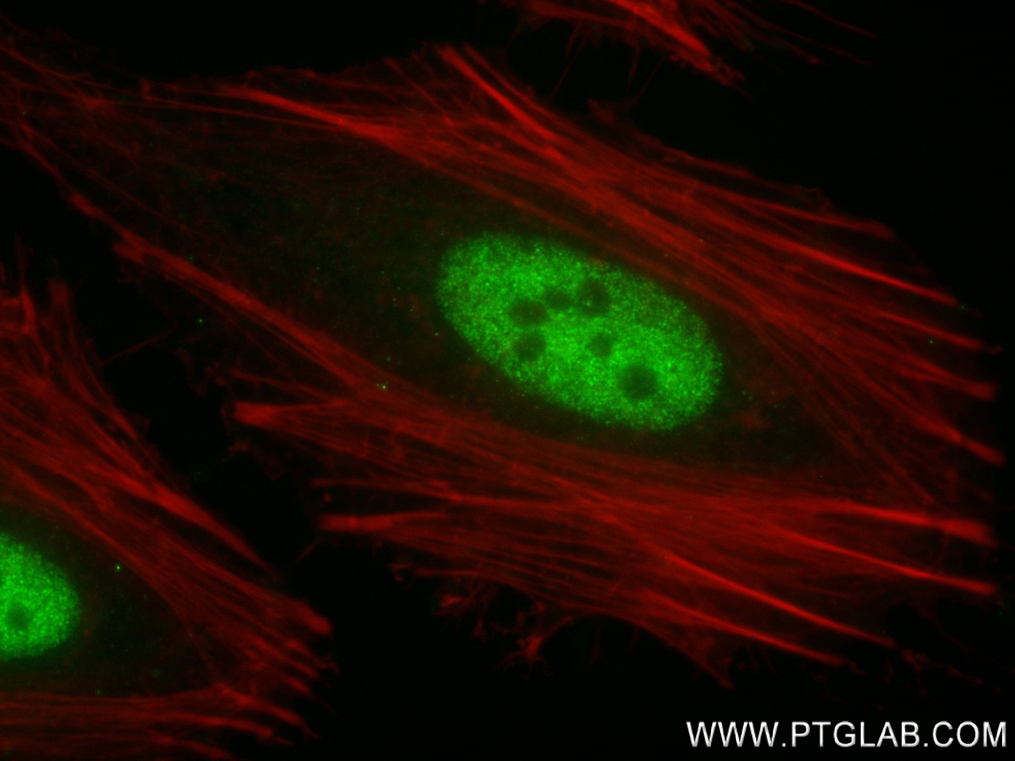 IF Staining of HeLa using 83662-7-RR (same clone as 83662-7-PBS)