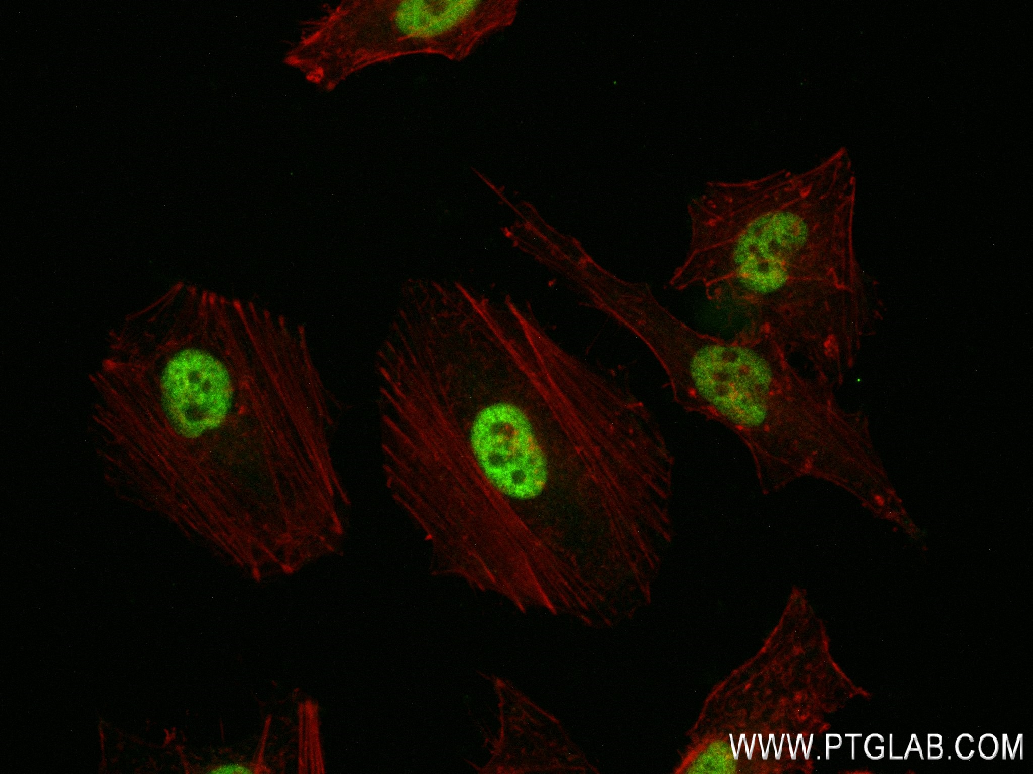 IF Staining of HeLa using 83662-7-RR (same clone as 83662-7-PBS)