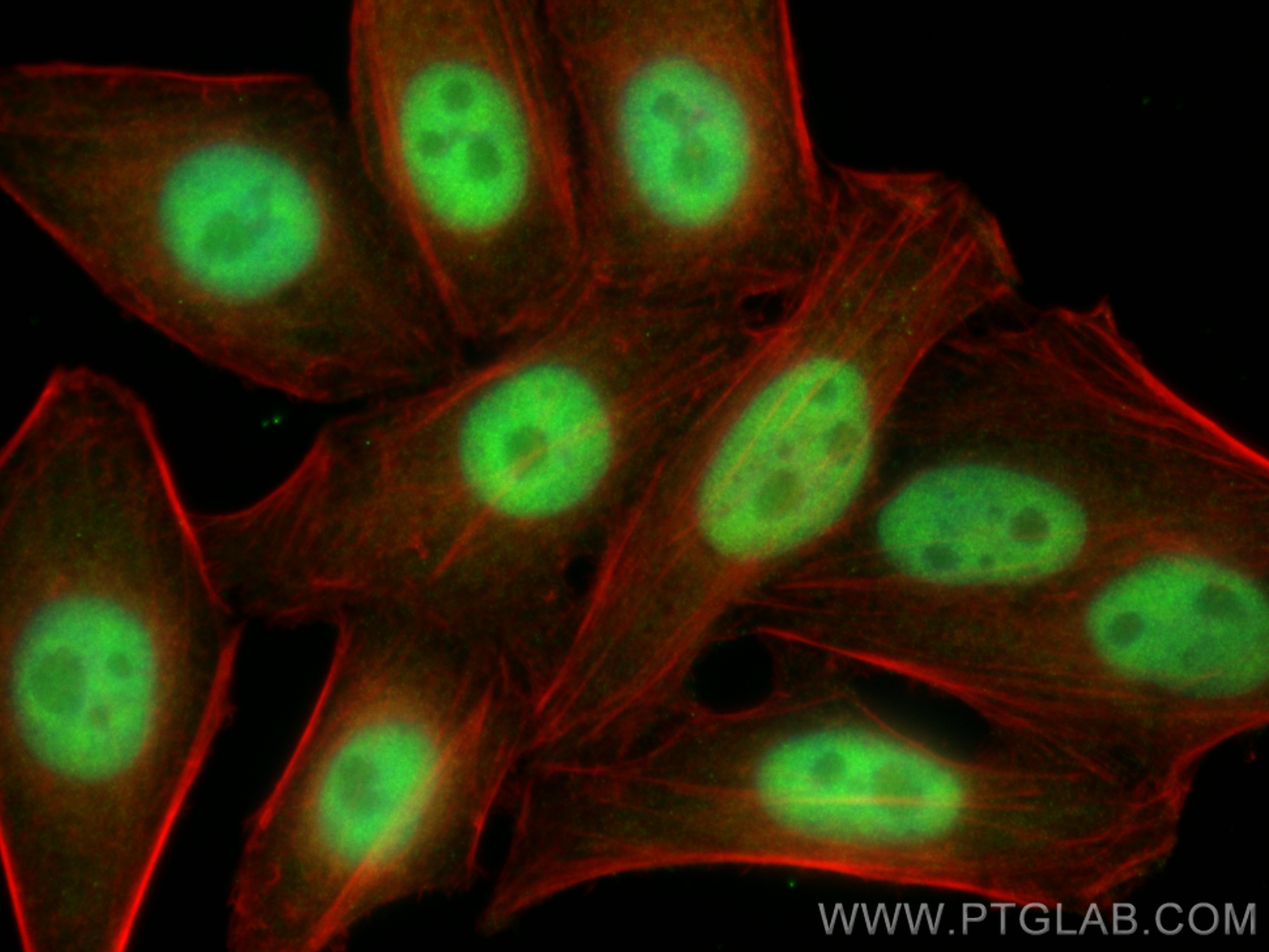 IF Staining of HepG2 using 16615-1-AP