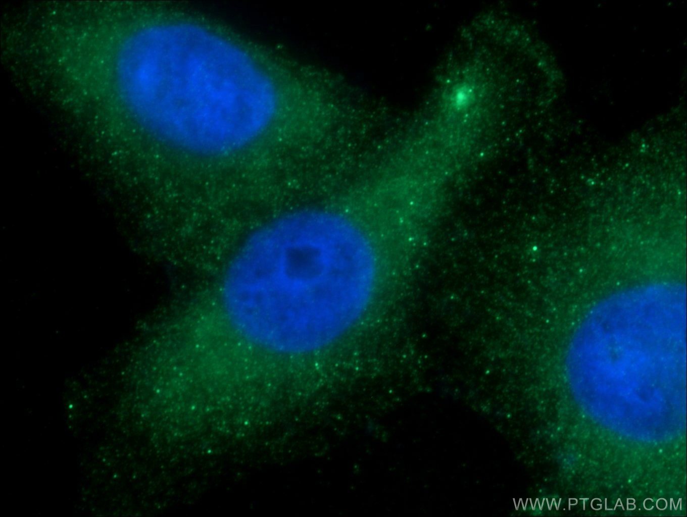 IF Staining of HepG2 using 14563-1-AP