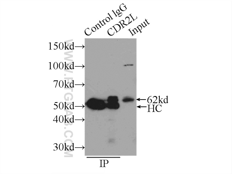 IP experiment of SH-SY5Y using 14563-1-AP