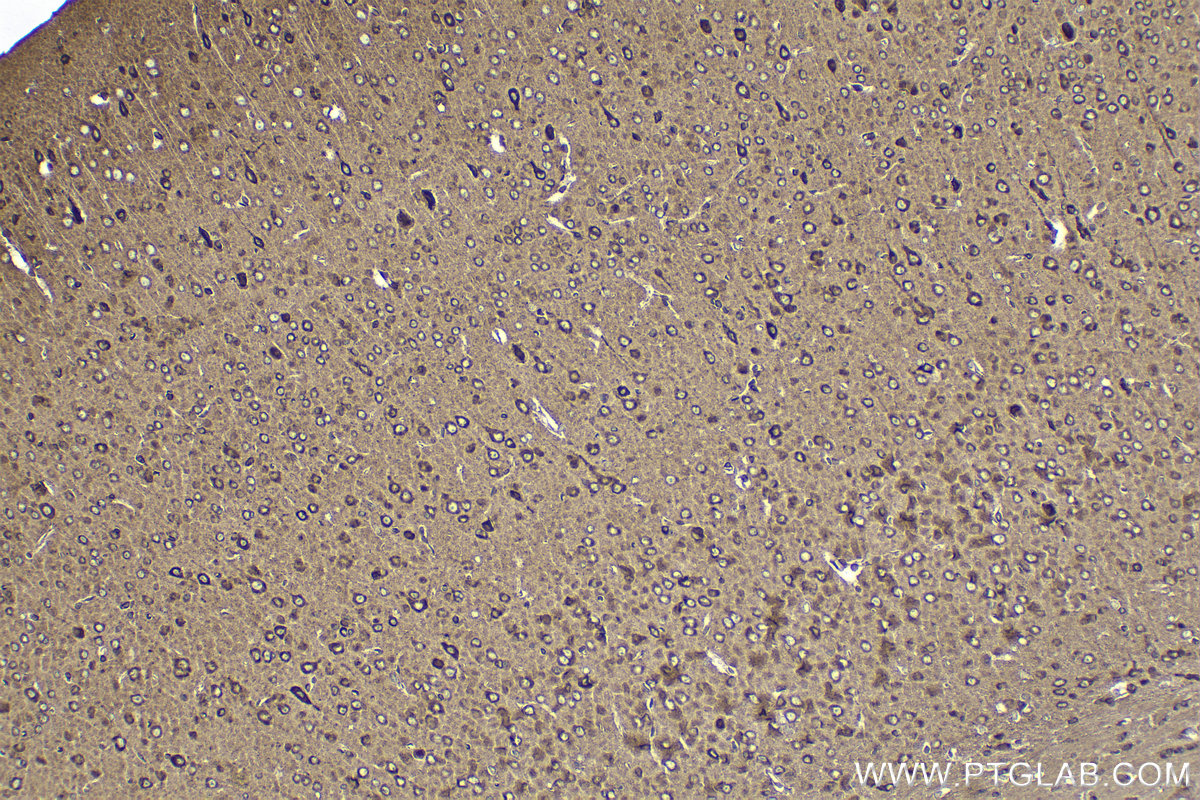 IHC staining of mouse brain using 28407-1-AP