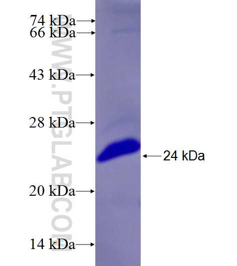 CDV3 fusion protein Ag26609 SDS-PAGE