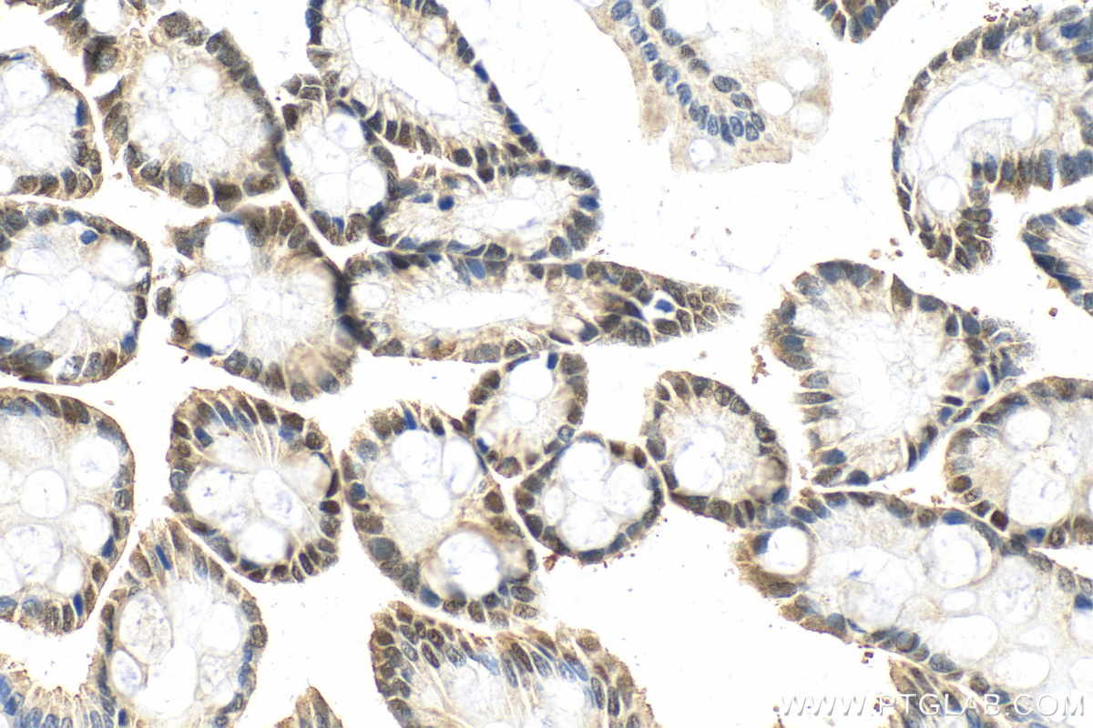 IHC staining of rat colon using 55286-1-AP