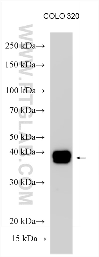 WB analysis of COLO 320 using 55286-1-AP