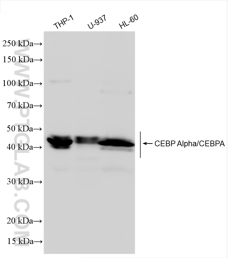 CEBP Alpha/CEBPA