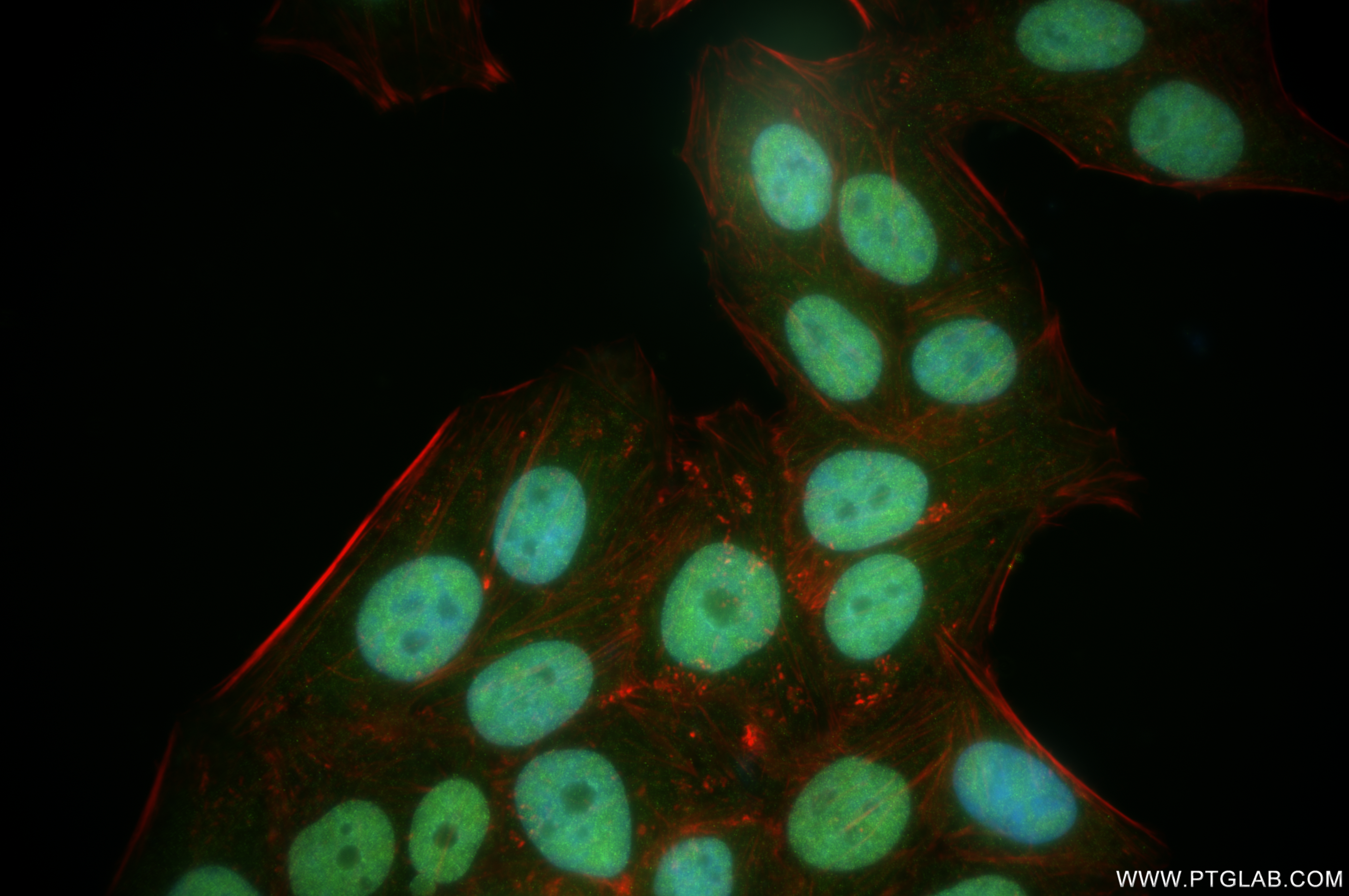 IF Staining of HepG2 using 84668-4-RR (same clone as 84668-4-PBS)