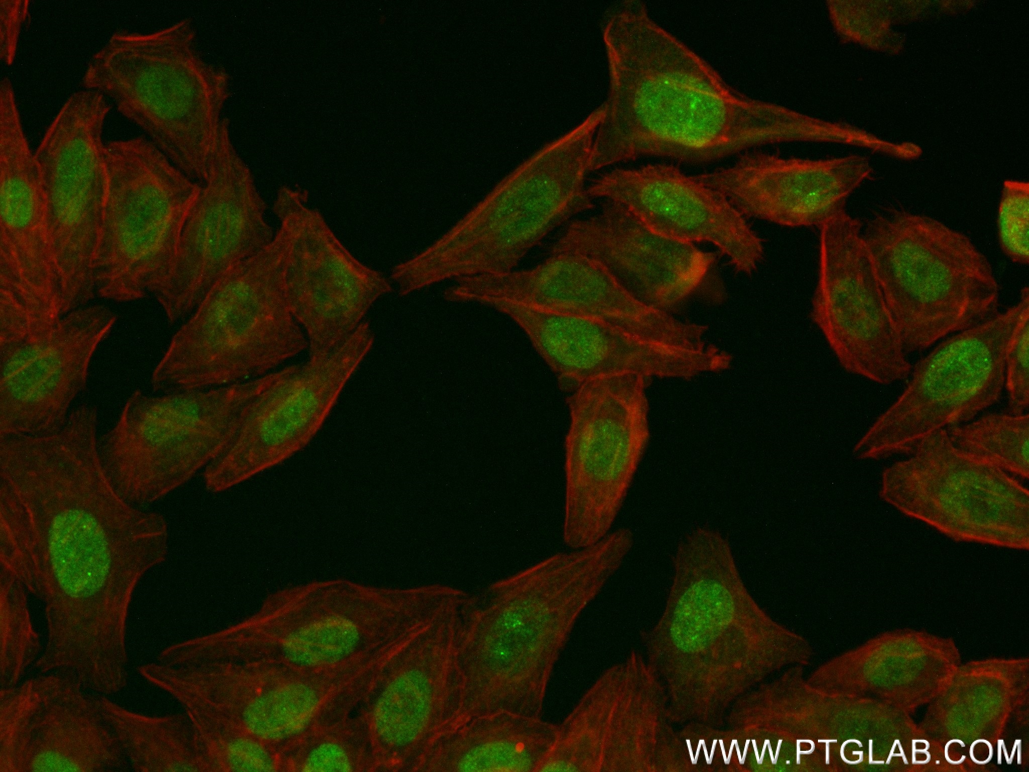 IF Staining of HepG2 using 83791-6-RR