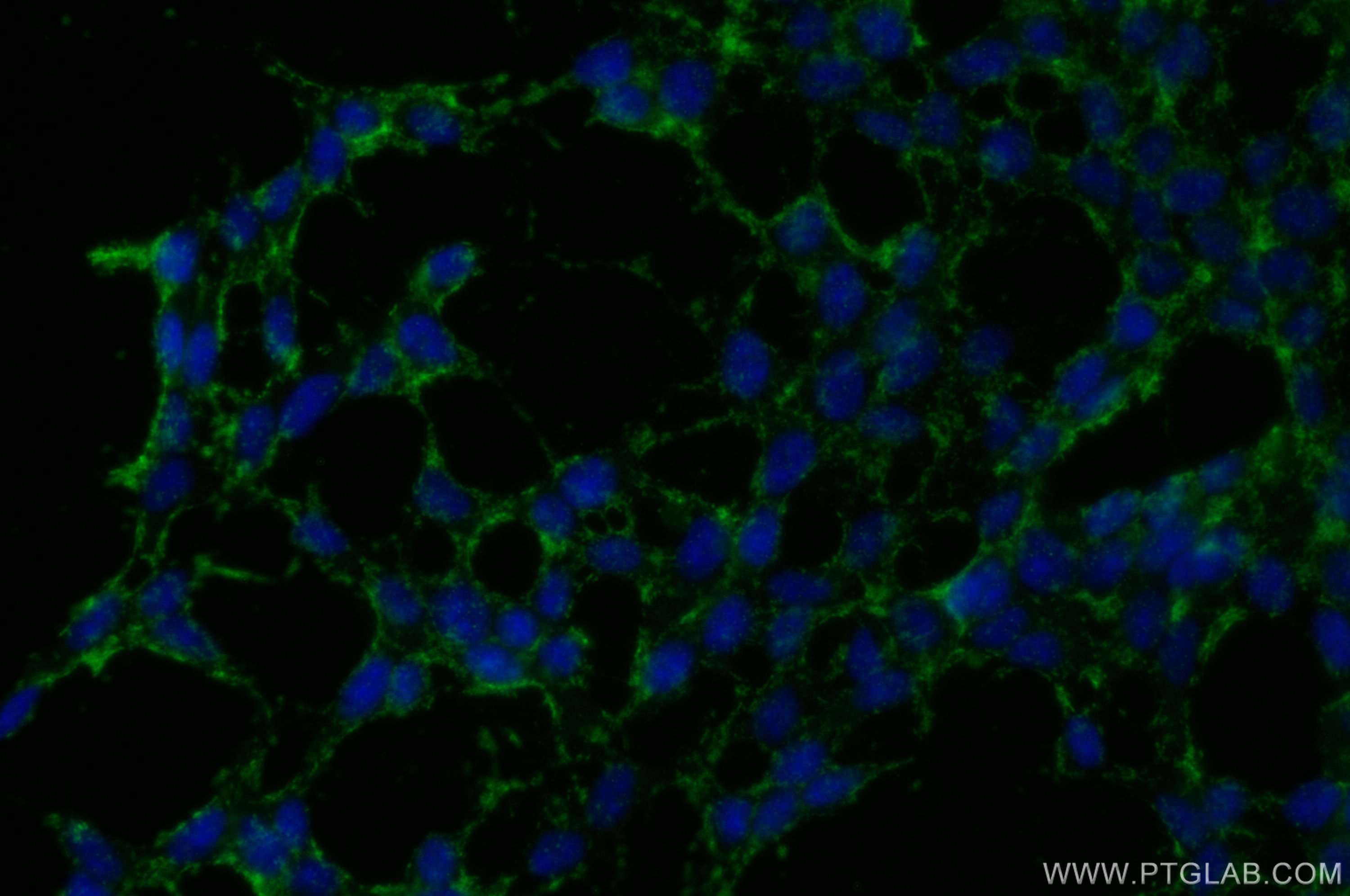 IF Staining of SH-SY5Y using 19940-1-AP