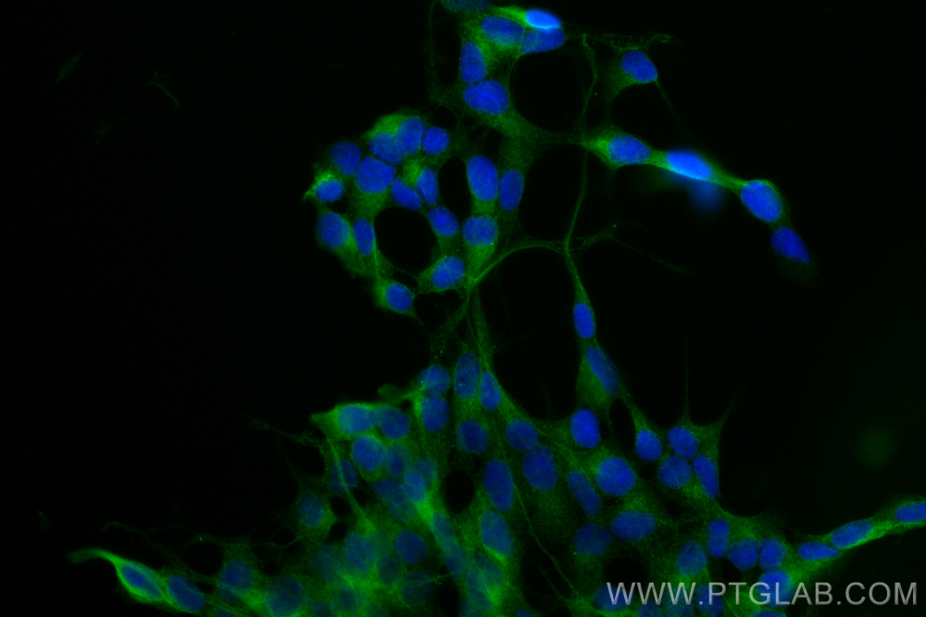 IF Staining of SH-SY5Y using CL488-83115