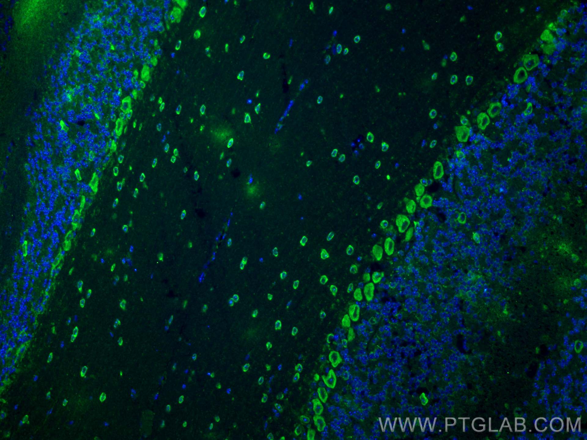 IF Staining of mouse cerebellum using 28835-1-AP