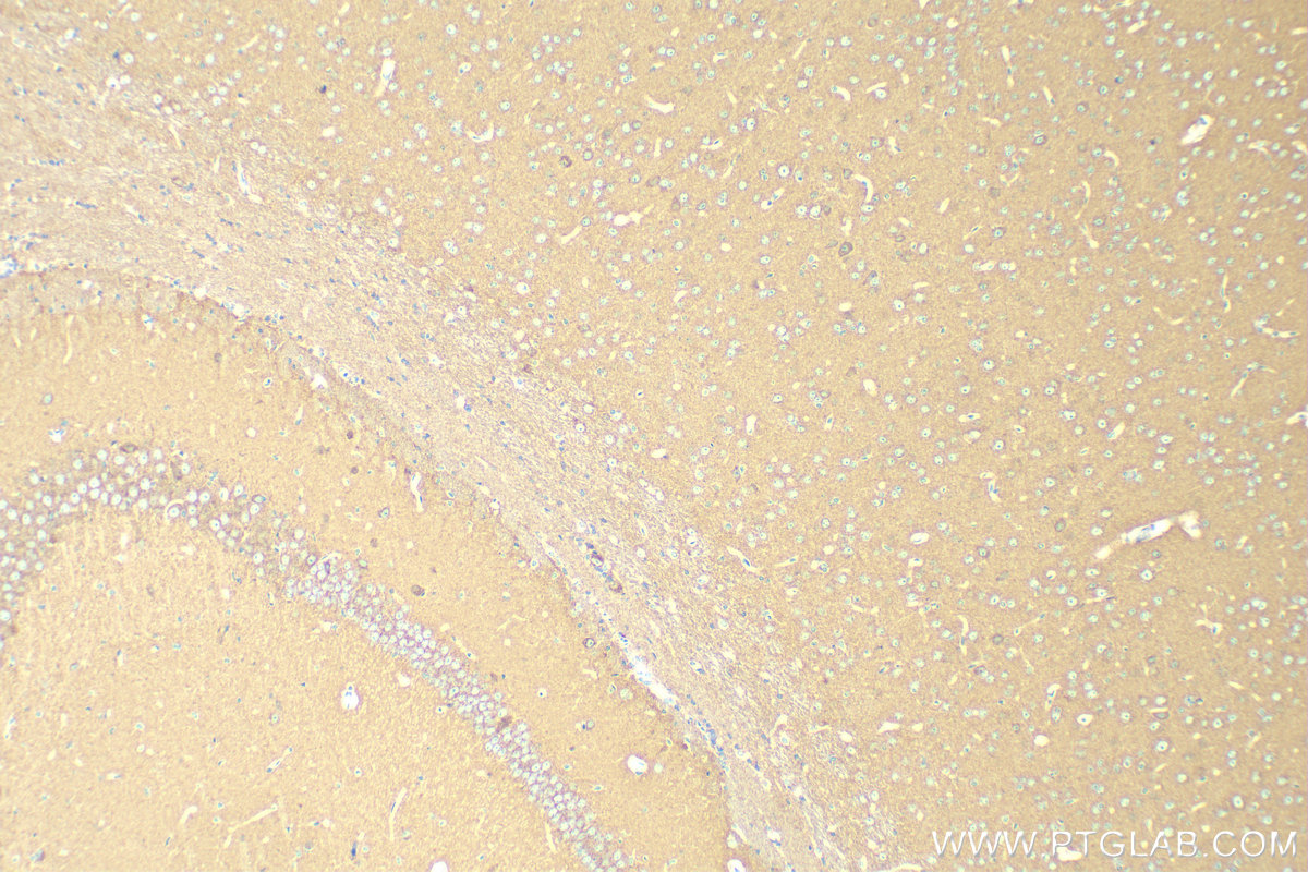 IHC staining of mouse brain using 13280-1-AP