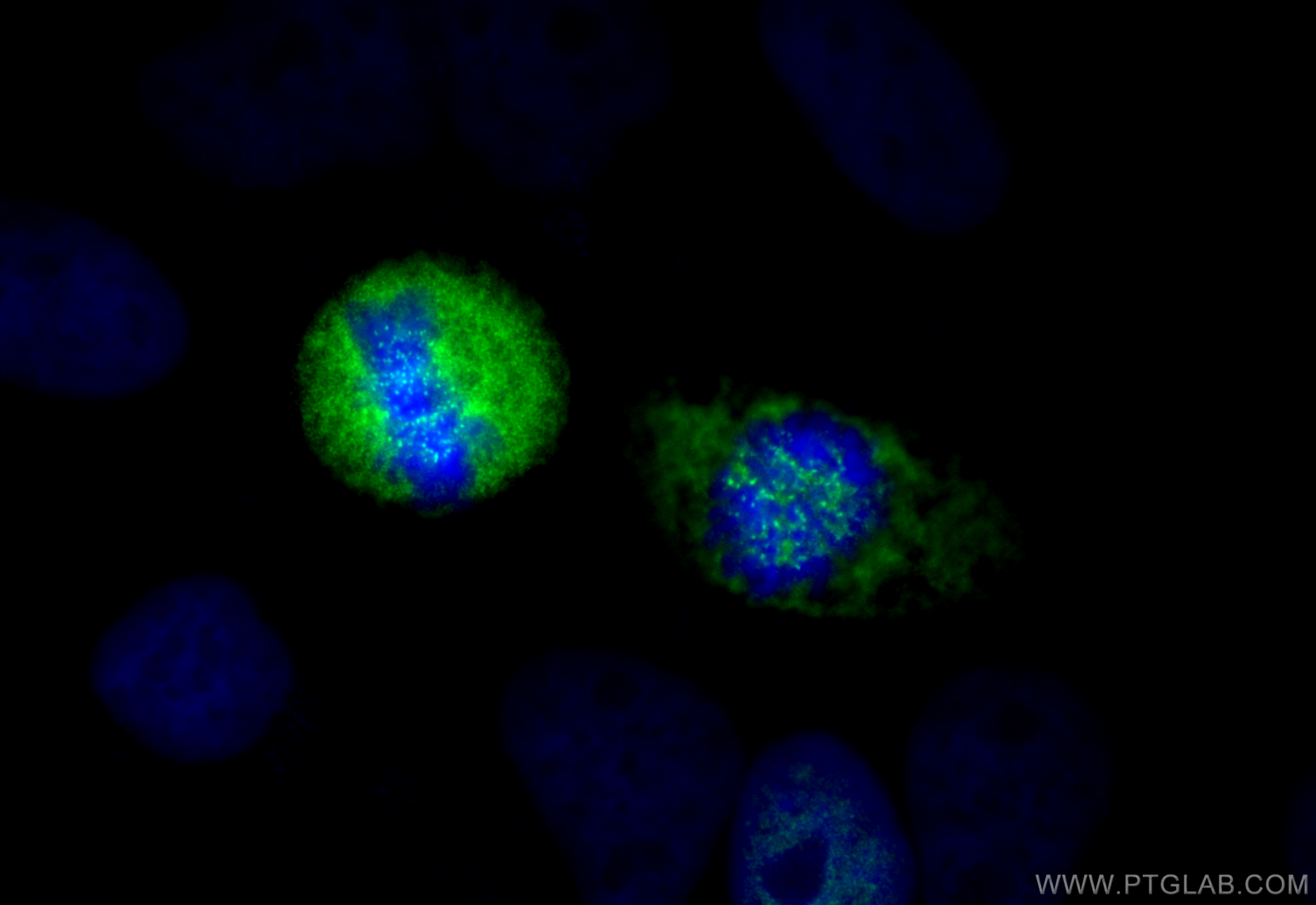 IF Staining of HeLa using 28568-1-AP (same clone as 28568-1-PBS)