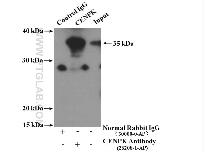 IP experiment of HeLa using 26208-1-AP