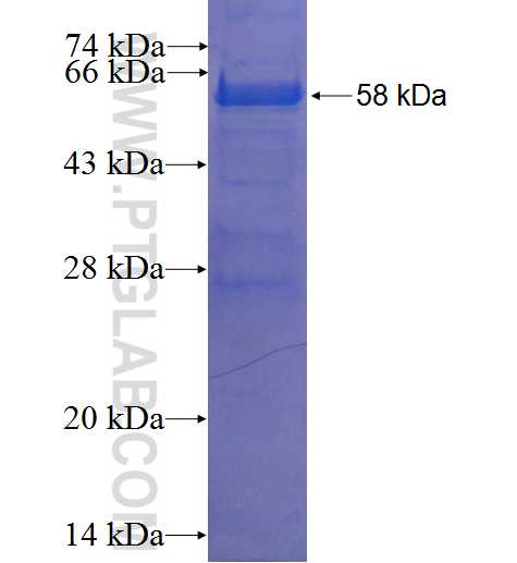 CENPK fusion protein Ag23812 SDS-PAGE