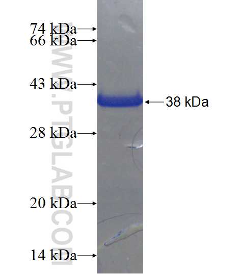 CENPK fusion protein Ag23823 SDS-PAGE