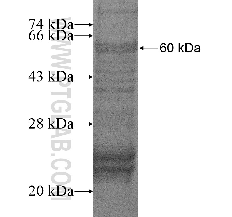 CENPO fusion protein Ag14619 SDS-PAGE