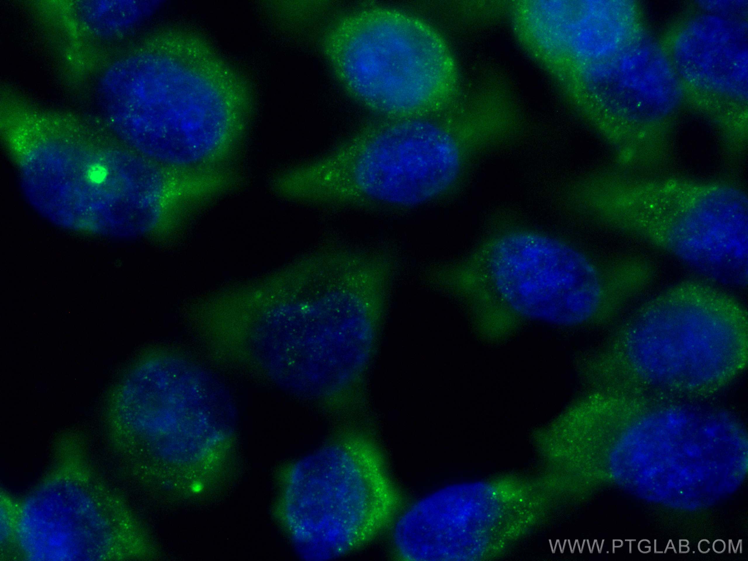 IF Staining of HeLa using 68715-1-Ig