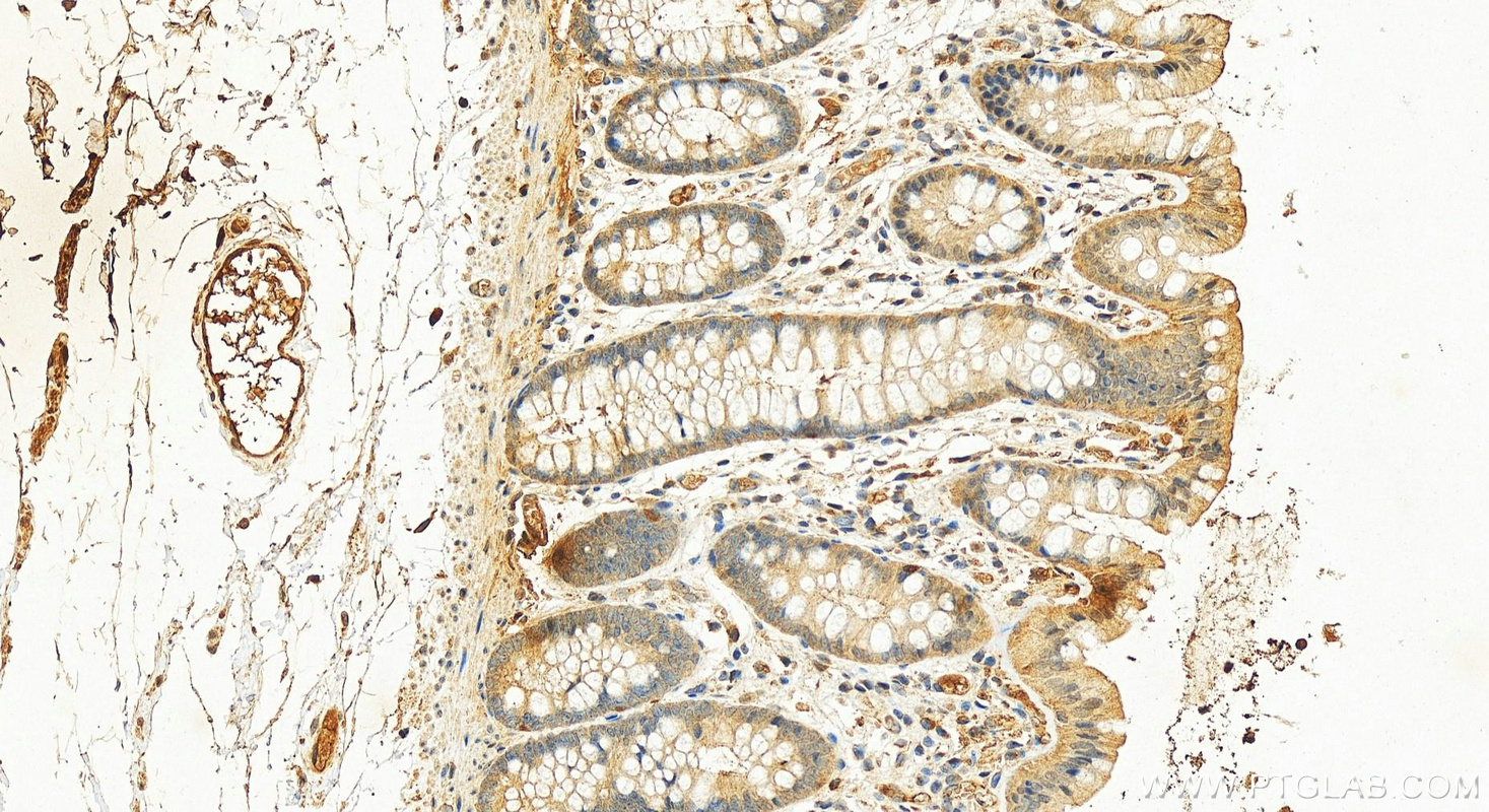 IHC staining of human colon using 22227-1-AP