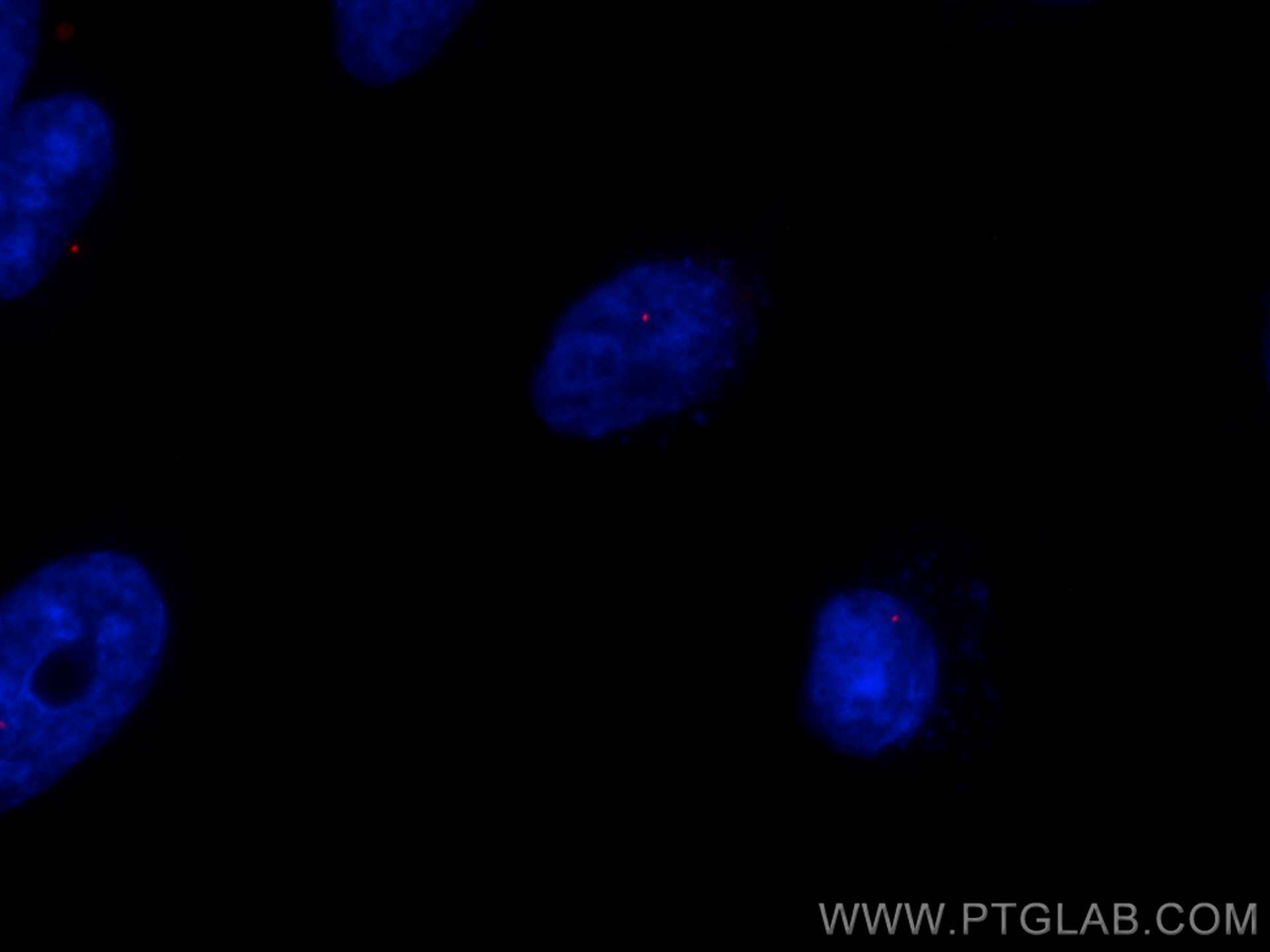 IF Staining of HeLa using CL594-22227