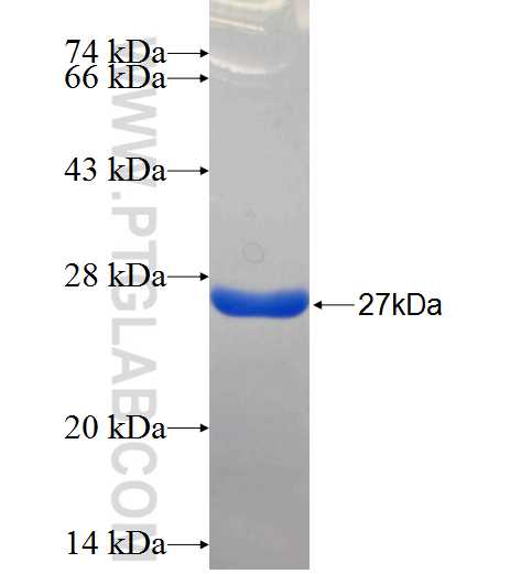 CEP170 fusion protein Ag26318 SDS-PAGE