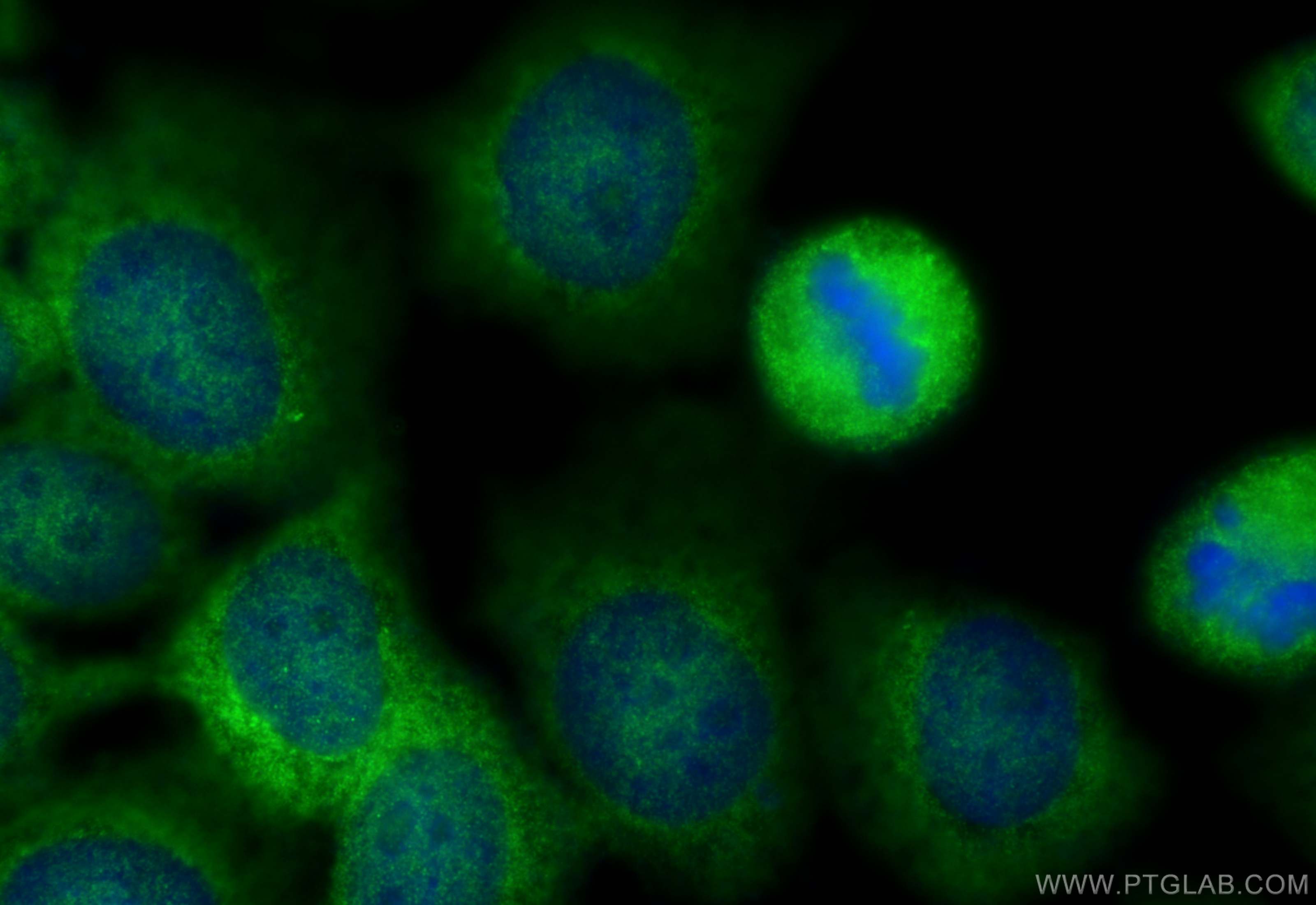 IF Staining of A431 using 20022-1-AP