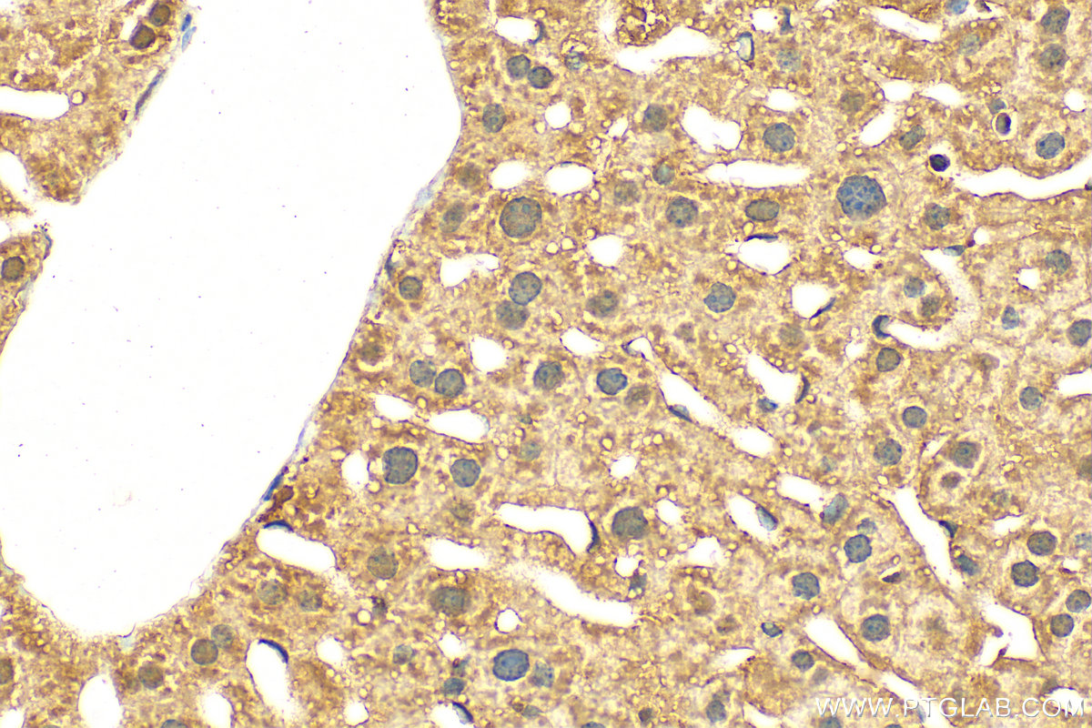 IHC staining of mouse liver using 20022-1-AP