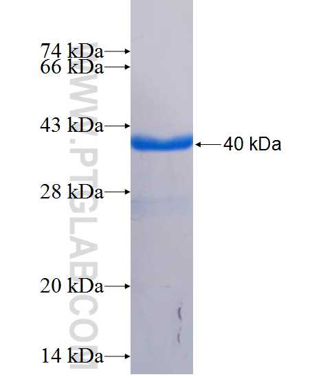 CEP68 fusion protein Ag26175 SDS-PAGE
