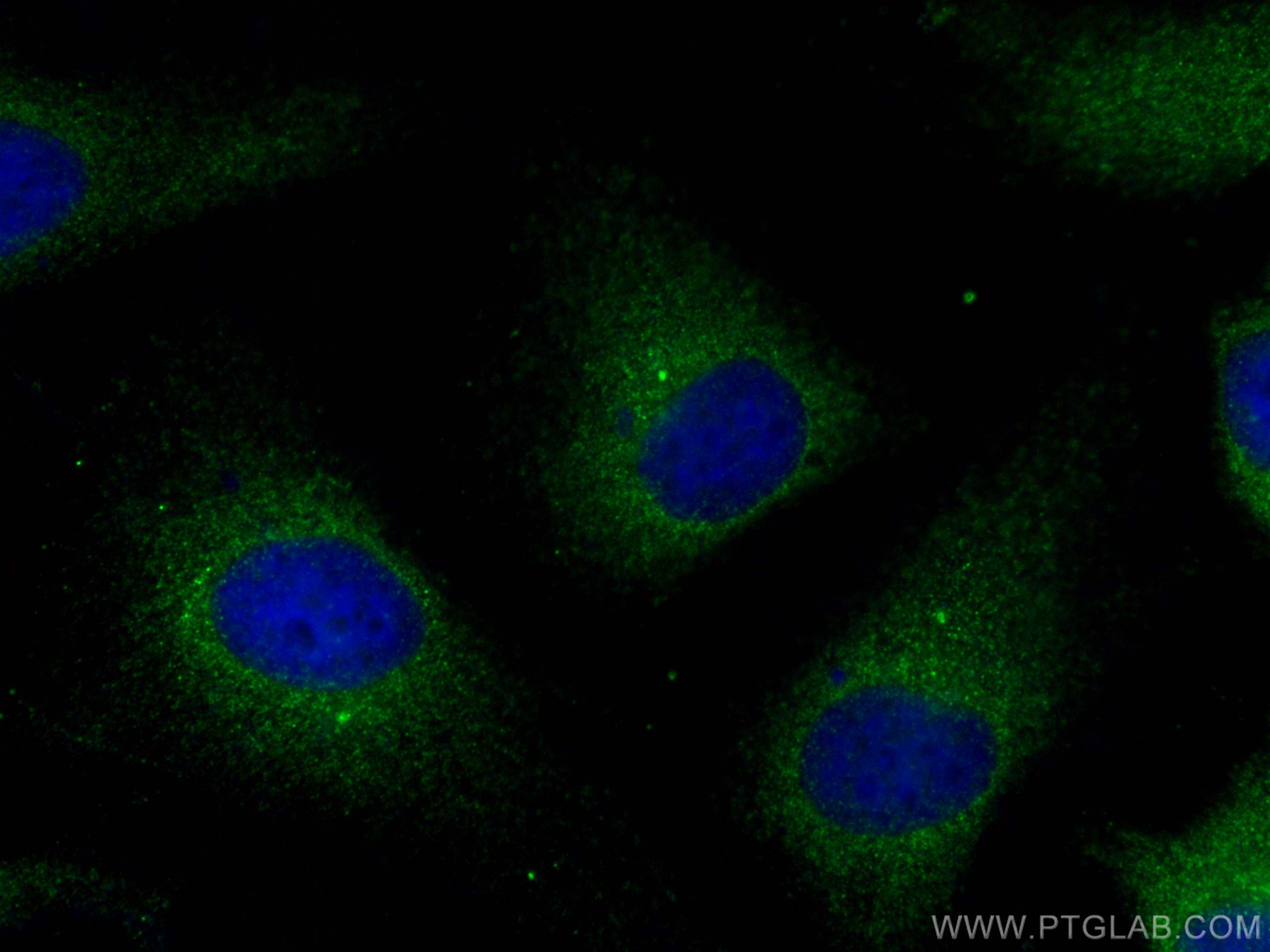 IF Staining of HeLa using 16280-1-AP