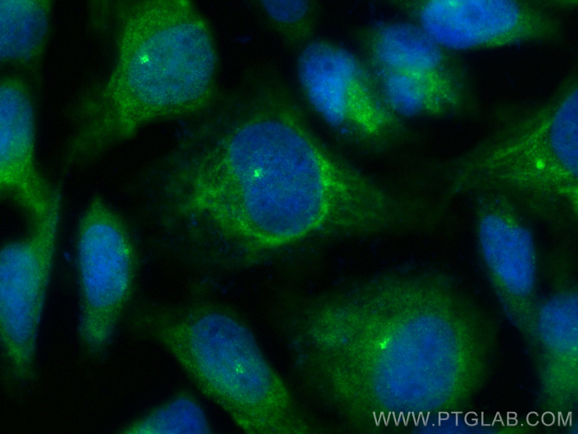 IF Staining of HeLa using 19928-1-AP