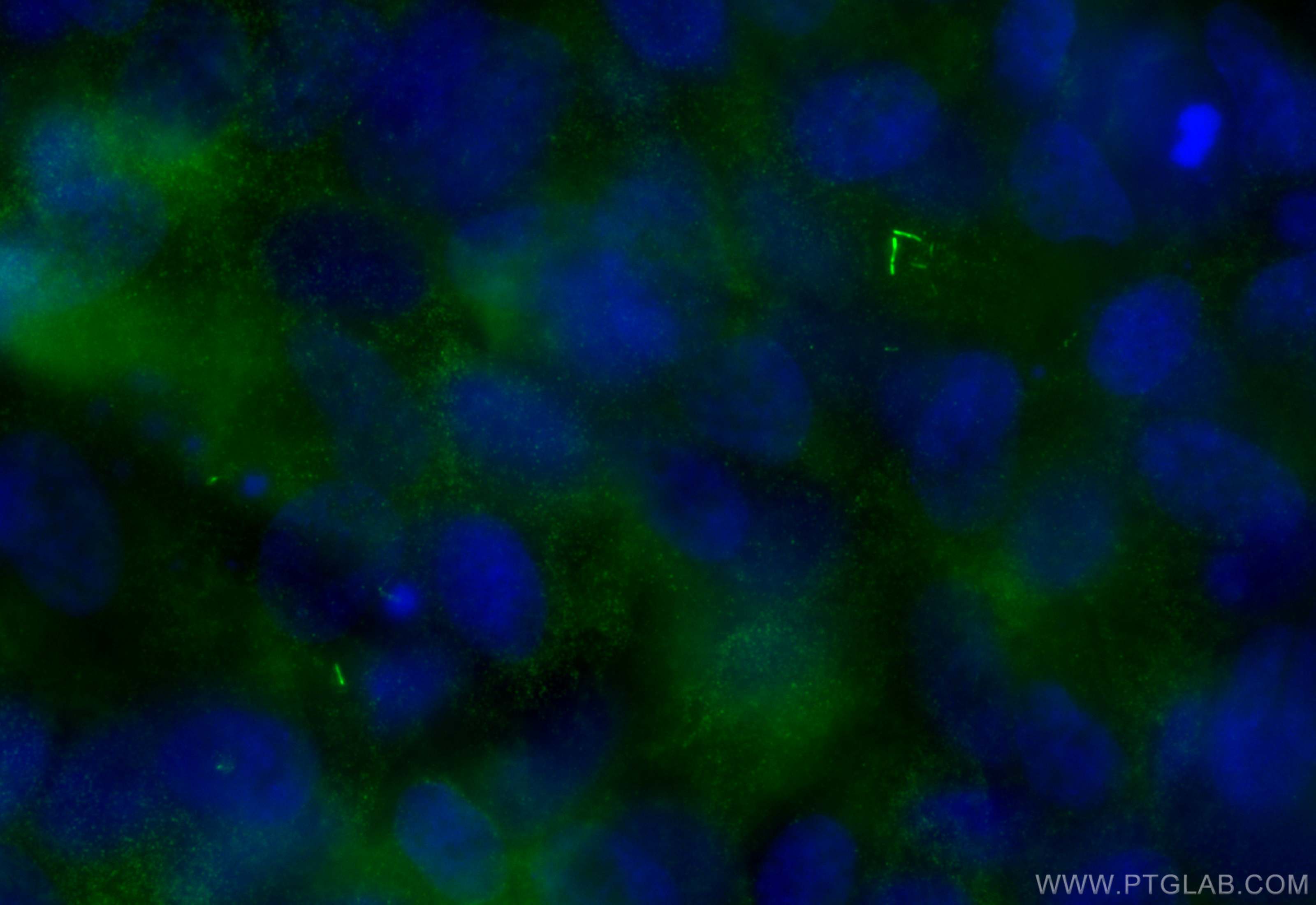 IF Staining of hTERT-RPE1 using 30165-1-AP