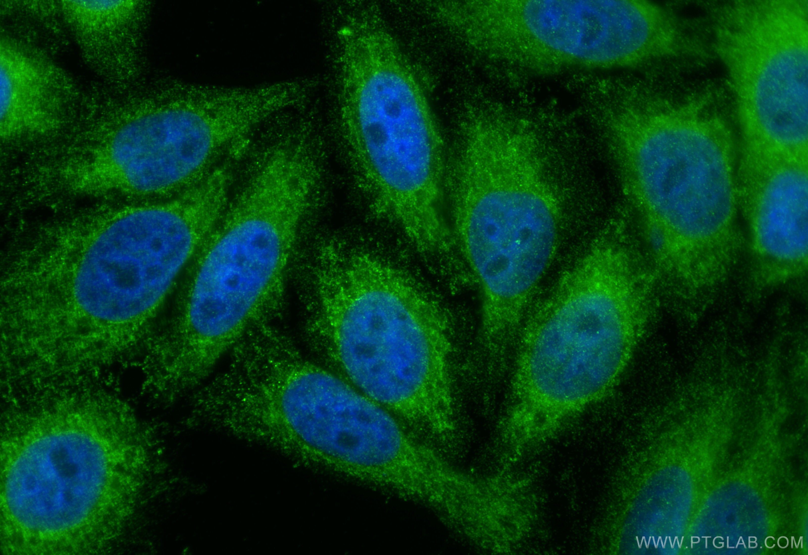 IF Staining of HepG2 using 16912-1-AP