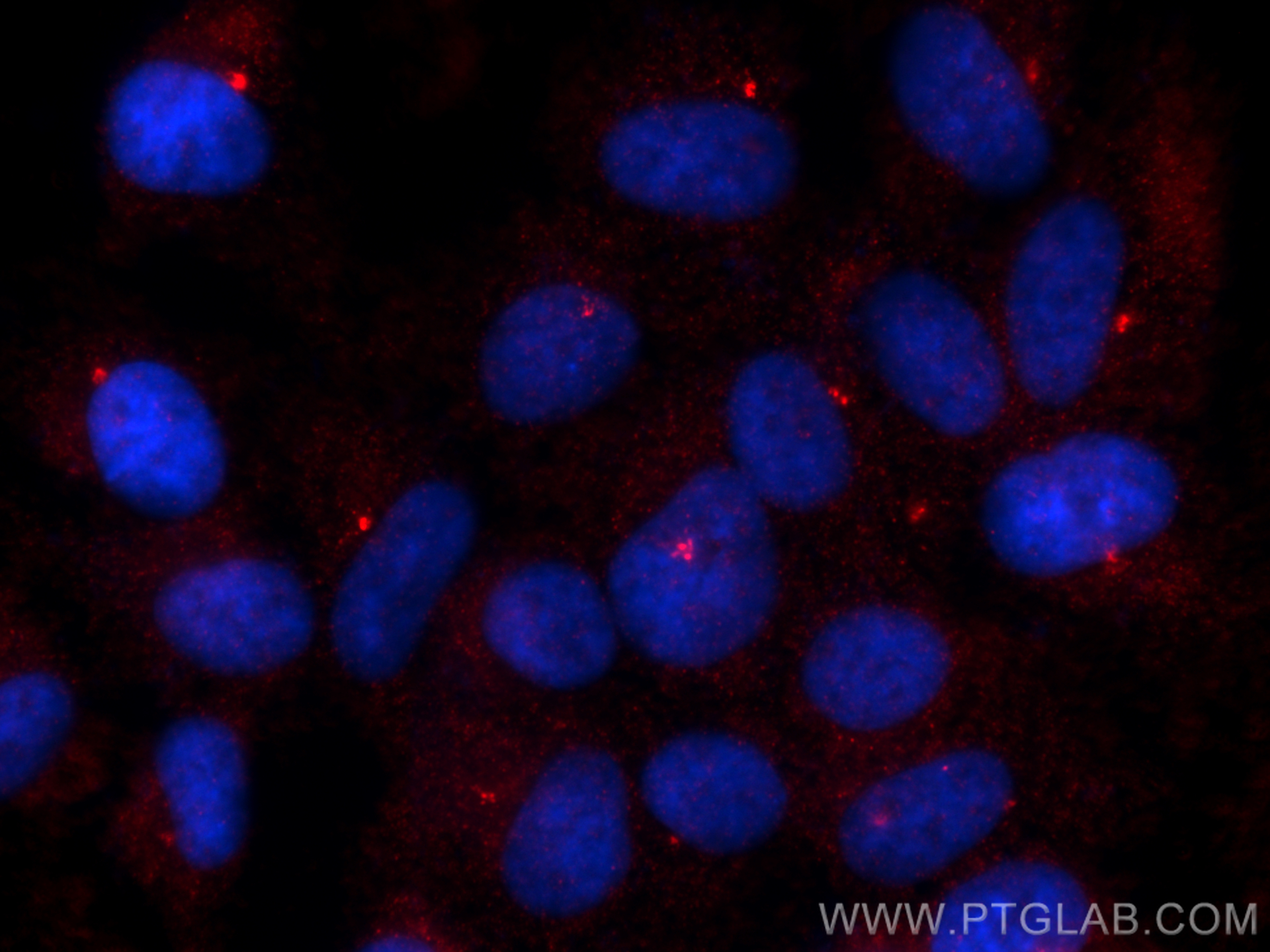 IF Staining of hTERT-RPE1 using 12794-1-AP