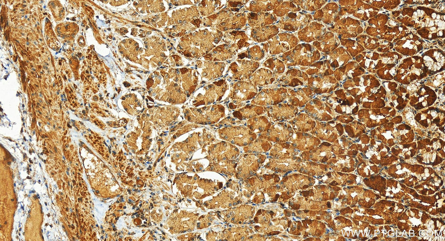 IHC staining of human stomach using 26050-1-AP