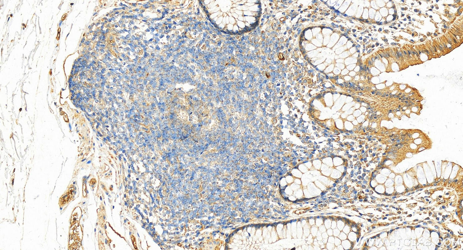 IHC staining of human normal colon using 12748-1-AP