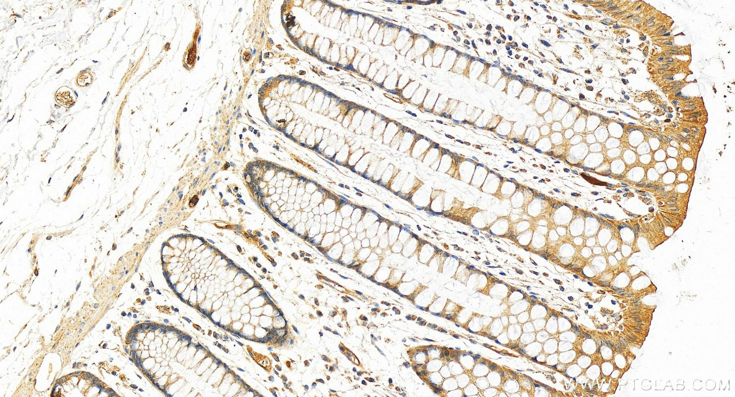 IHC staining of human normal colon using 12748-1-AP