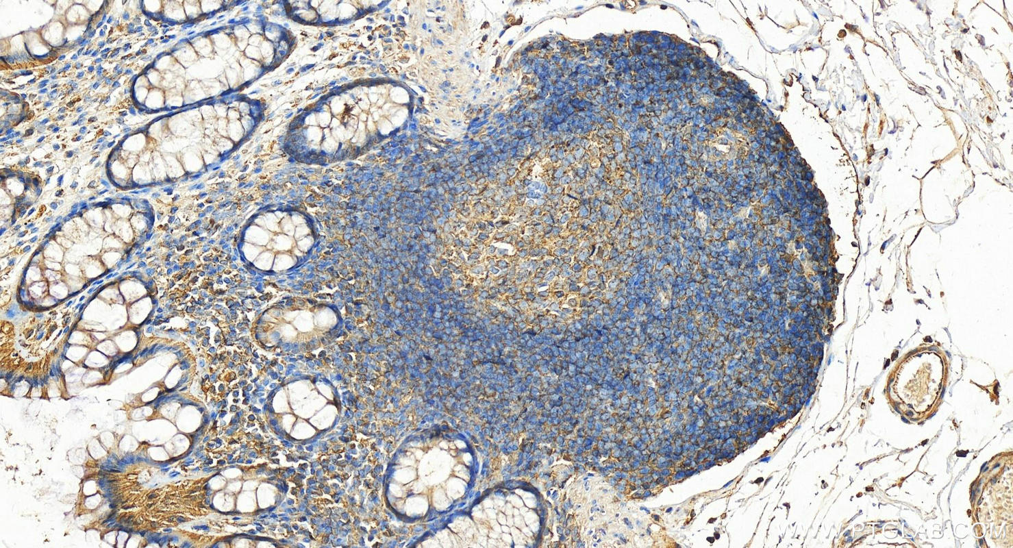 IHC staining of human colon using 10960-1-AP