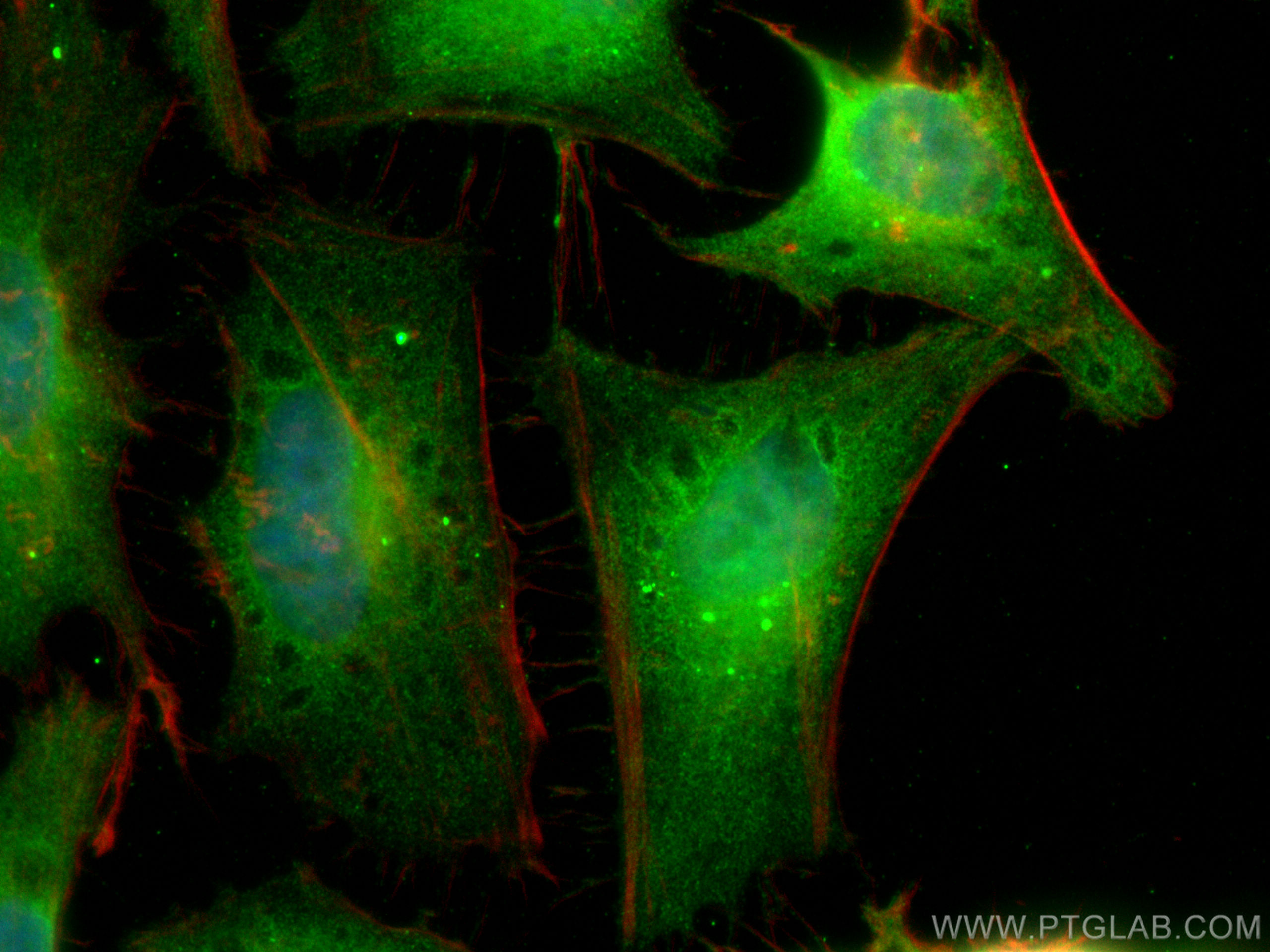 IF Staining of HeLa using 66057-1-Ig (same clone as 66057-1-PBS)