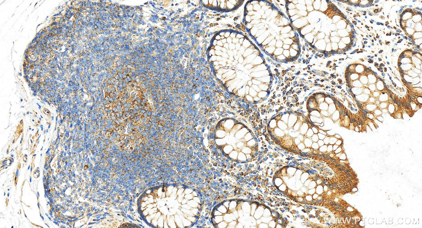 IHC staining of human normal colon using 11848-1-AP