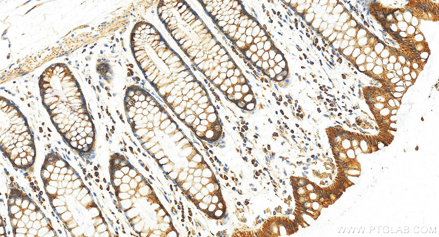 IHC staining of human normal colon using 11848-1-AP