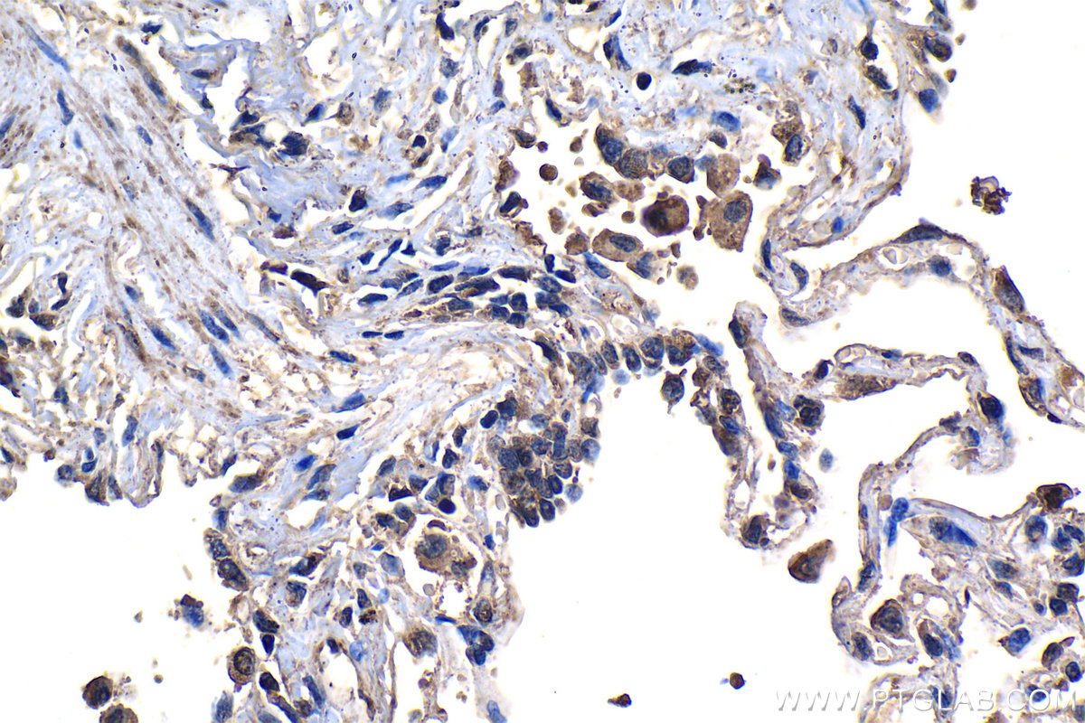 IHC staining of human lung using 66928-1-Ig