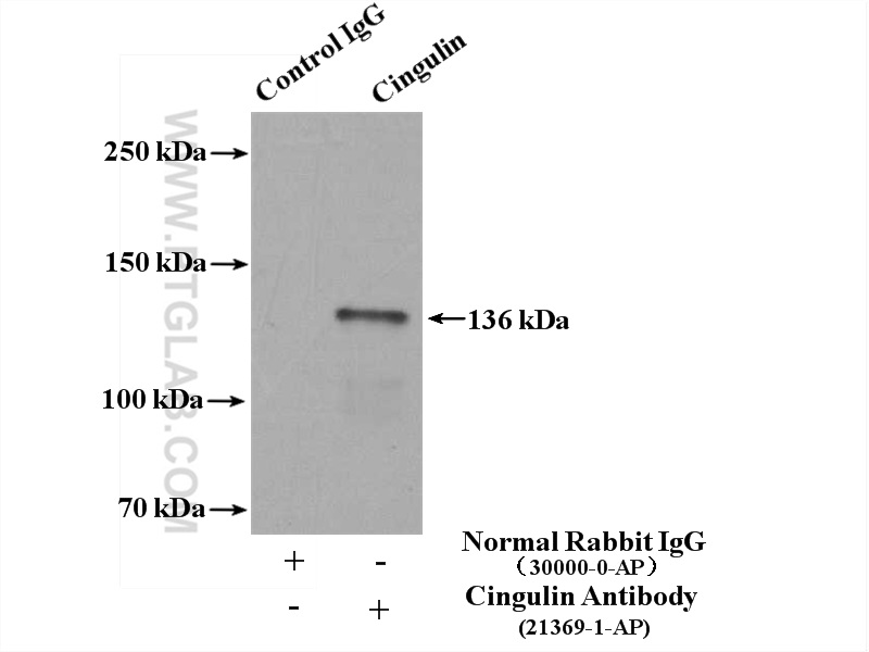 IP experiment of mouse kidney using 21369-1-AP