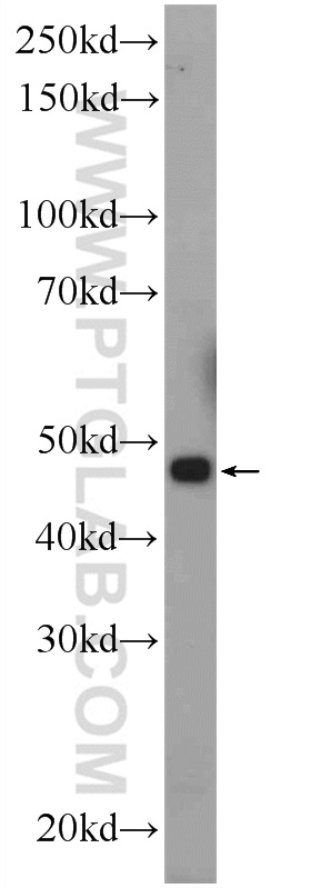 WB analysis of rat kidney using 16101-1-AP