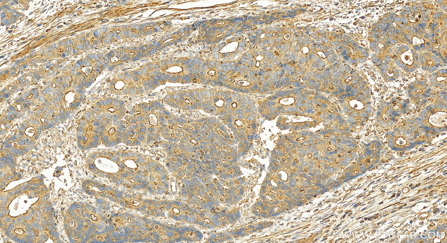 IHC staining of human stomach using 15207-1-AP