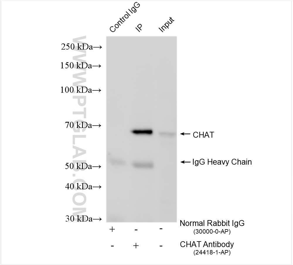 IP experiment of rat brain using 24418-1-AP