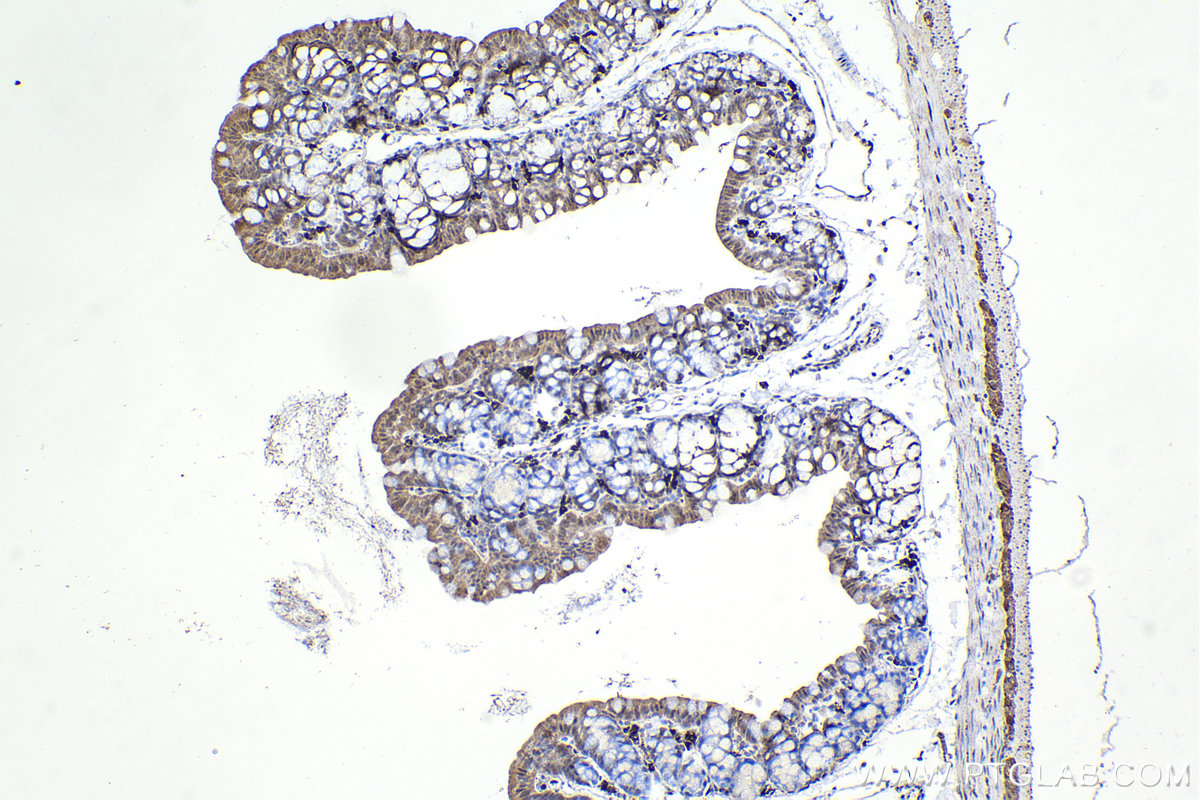 IHC staining of mouse small intestine using 66816-1-Ig (same clone as 66816-1-PBS)