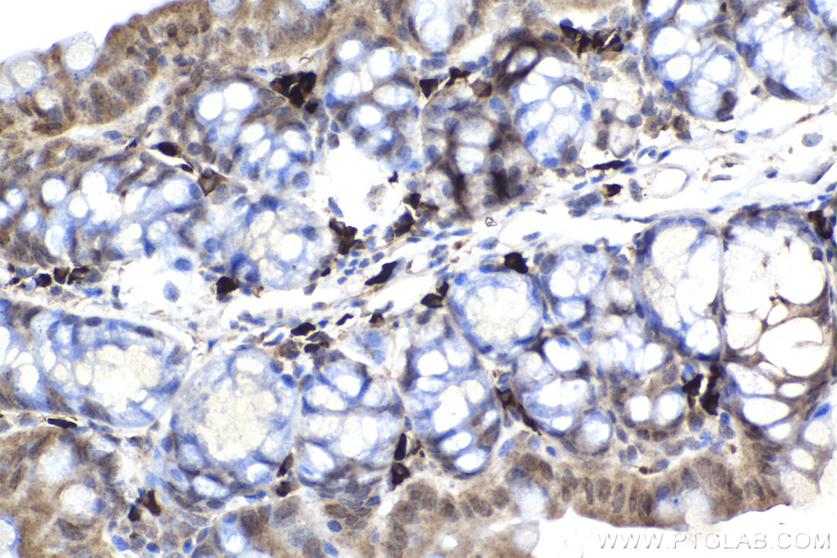 IHC staining of mouse small intestine using 66816-1-Ig (same clone as 66816-1-PBS)