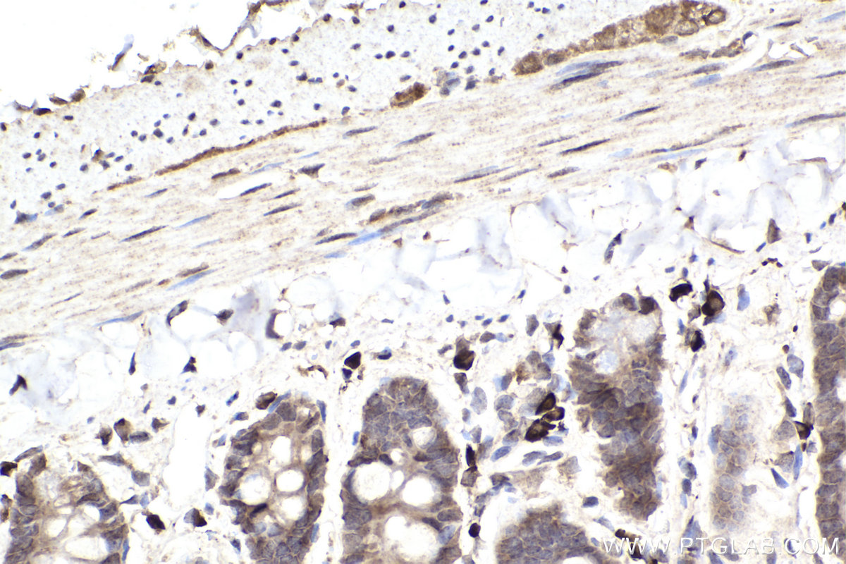 IHC staining of rat small intestine using 66816-1-Ig (same clone as 66816-1-PBS)