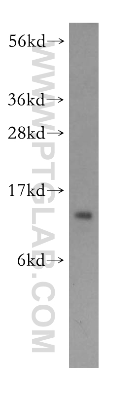 WB analysis of A431 using 11728-1-AP